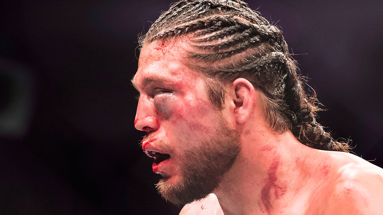 Brian-Ortega-leaves-Octagon-after-loss-to-Max-Holloway-at-UFC-231