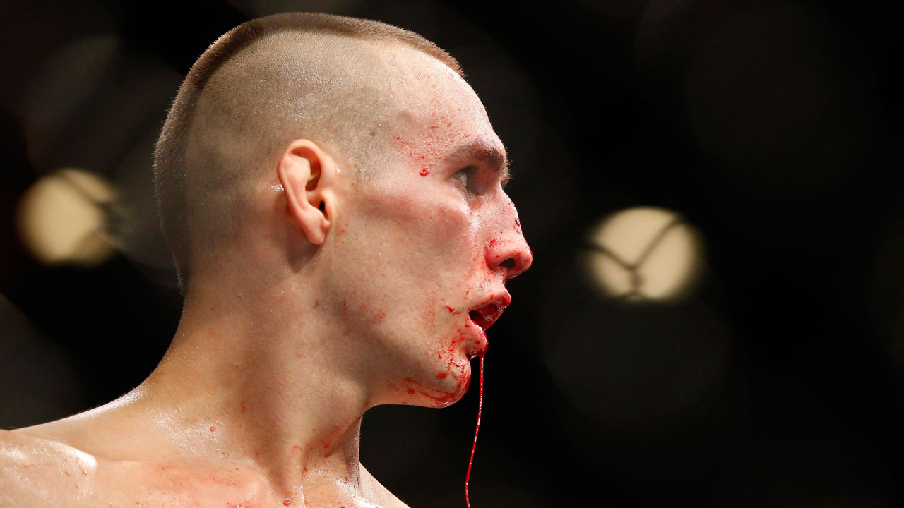 Blood drips from Rory MacDonald during his welterweight title bout.
 (John Locher/AP)