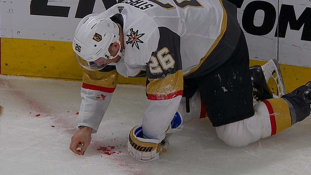 Hockey Feed - A close up look at the damage done to McDavid's teeth.