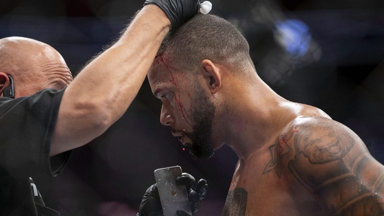 Thiago Santos is worked on by his corner after the end of the third round of a light heavyweight mixed martial arts title bout against Jon Jones at UFC 239 Saturday, July 6, 2019, in Las Vegas. Jones won by split decision. (Eric Jamison/AP)