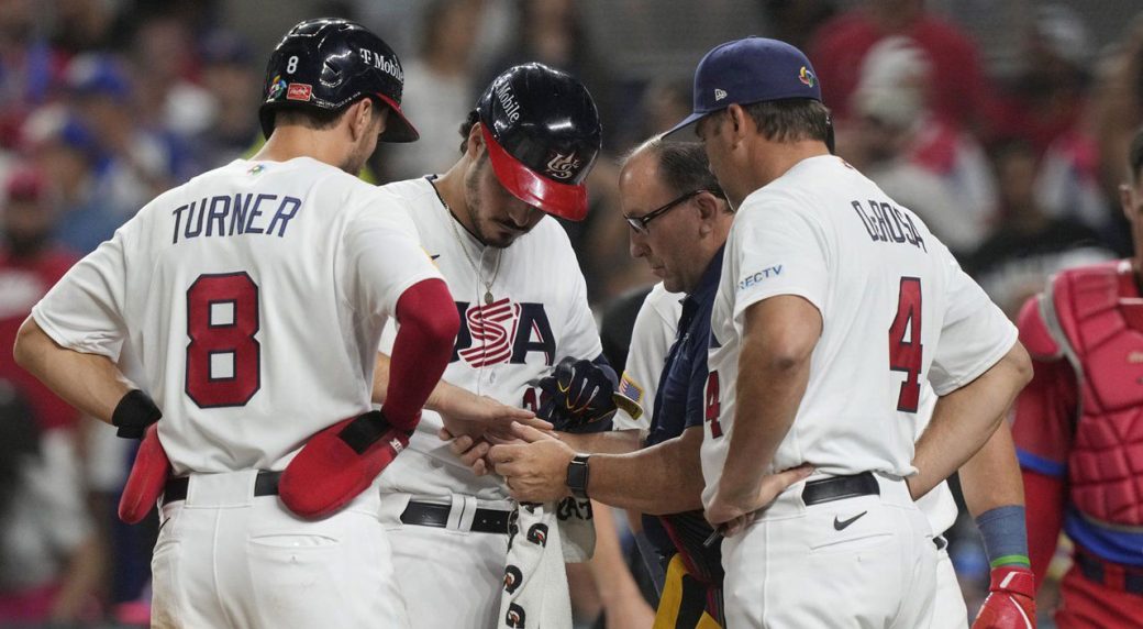 Cardinals’ Arenado hit by pitch at WBC one night after Altuve breaks thumb