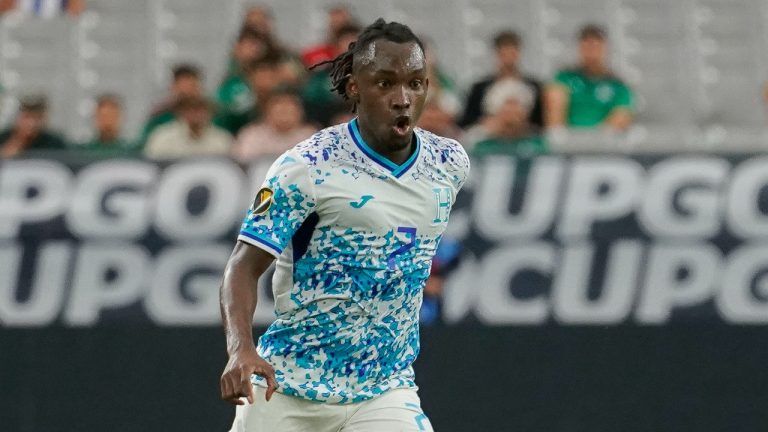 Honduras striker Alberth Elis remains in an induced coma after suffering a head injury when playing for Bordeaux, the French club said Sunday. (AP/Darryl Webb)