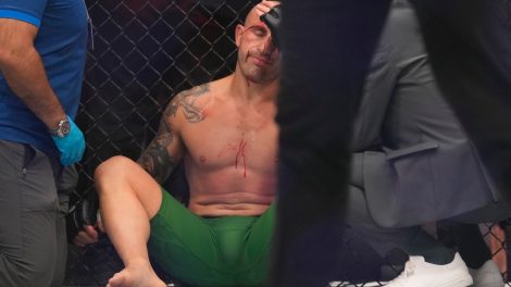 Alex-Volkanovski-reacts-after-he-was-beaten-by-Islam-Makhachev-by-knockout-at-UFC-294