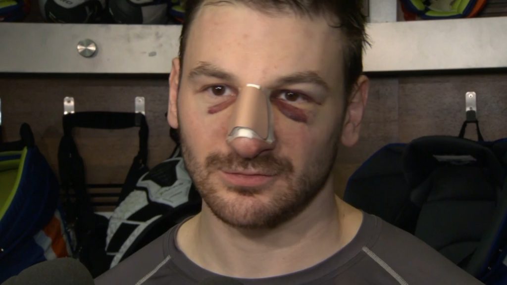 Zach Hyman Injury Oilers' Hyman on history of broken noses: 'This one is probably worse'