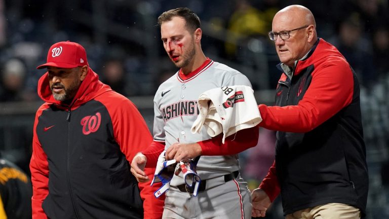 Washington Nationals' Paul DeJong, center, is helped off the field after getting hit by a pitch by Pittsburgh Pirates' Mitch Keller during the sixth inning of a baseball game Tuesday, April 15, 2025, in Pittsburgh. (AP Photo/Matt Freed)