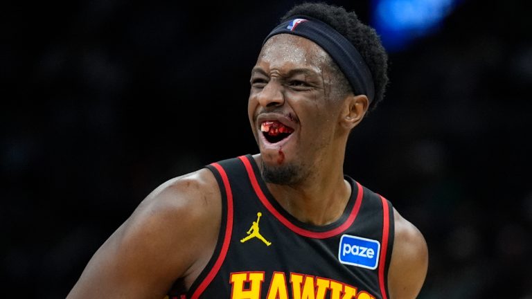 Atlanta Hawks forward Onyeka Okongwu (17) grimaces after being flagrantly fouled by Boston Celtics guard Jaylen Brown (7) during the second half of an NBA basketball game Wednesday, Jan. 28, 2026, in Boston. (Robert F. Bukaty/AP)