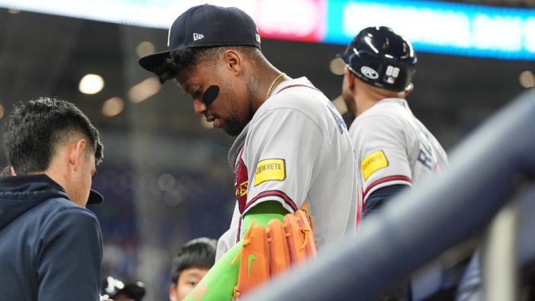 Atlanta Braves' Ronald Acuna, right, has his finger looked at during the fifth inning of a baseball game against the Miami Marlins, Thursday, May 21, 2026, in Miami. (Lynne Sladky/AP)