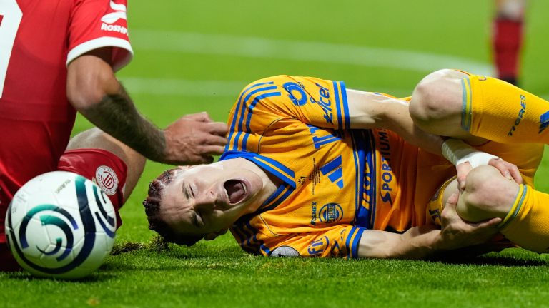 Tigres' Marcelo Flores grimaces in pain during the Concacaf Champions Cup final soccer match against Toluca in Toluca, Mexico, Saturday, May 30, 2026. (Fernando Llano/AP)